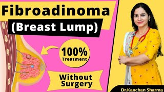 Fibroadenoma Breast  Lump In Breast  Fibroadenoma Breast Natural Treatment and Permanent Cure [upl. by Eerased]