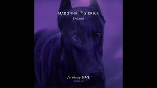 Madonna x Sickick  Frozen Fireboy DML Remix Official Audio [upl. by Ecyarg]