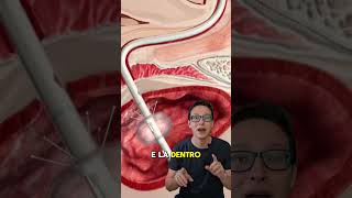 Como voce urina na cirurgia 😯🚽 enfermagem medico saude curiosidades [upl. by Orlantha]