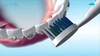 Irrigador Oral com Fio Dental Jetpik JP50  Submarinocombr [upl. by Arbmik]