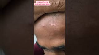 Best Skin Clinic in Nagpur Dr Madhuri Anantwar DermatologistJaripatkaNagpur tattooremoval [upl. by Deb203]