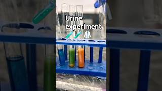 Urine Experiment shorts experience ⚕️🩺😍 [upl. by Okihsoy]