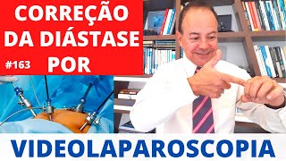 Correção da DIÁSTASE por Videolaparoscopia Cirurgia Plástica [upl. by Fried]