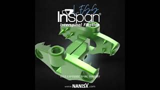 KIC Ventures Inspan Interspinal Fixation [upl. by Reiniar]