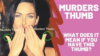 Murders Thumb – What Does it Mean if You Have a Clubbed Thumb Brachydactyly – Hand Analysis [upl. by Guss403]