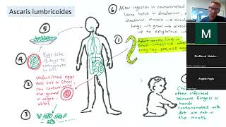 2023 15 Soil transmitted helminth infections in children [upl. by Northrop]