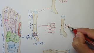 5th Metatarsal Fracture Exercises  Jones Fracture Rehab Exercises  Foot Fracture Physical Therapy [upl. by Sessler668]