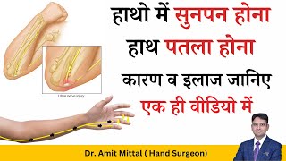 क्यों रहता हैं उंगलियों में सुनपन और हाथ का पतला होना। कारण व इलाज  Nerve Disorders [upl. by Aseefan]