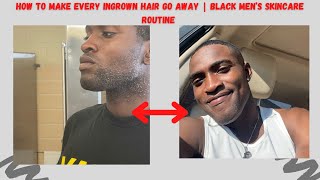 How to make every Ingrown hair go away  Black Men’s Skincare Routine  2021 [upl. by Rapsag]