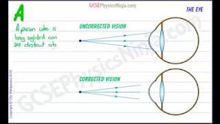 Long Sighted Vision Correction  Physics of Light [upl. by Siraved]