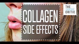 Collagen Side Effects  Collagen Protein  What Are The Side Effects Of Collagen Supplements [upl. by Aletse]