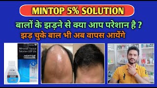 Mintop 5 solution use benefits and Side effects full review hindiminoxidil [upl. by Ahsieyt239]