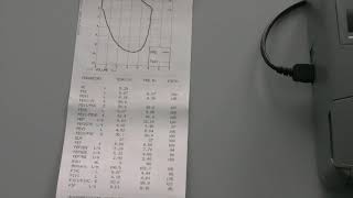 Impostazioni e configurazione spirometro Mir Spirolab III [upl. by Hansen]