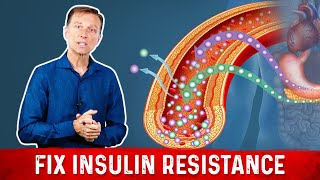 7 Things That Boost Insulin Sensitivity or Reverse Insulin Resistance  Dr Berg [upl. by Donetta]