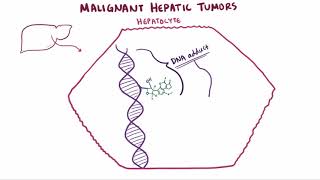 Malignant liver tumors causes symptoms diagnosis treatment amp pathology [upl. by Avram680]