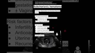 Subchorionic hematoma [upl. by Wrennie572]