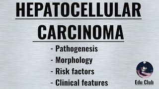 Hepatocellular Carcinoma  HCC   Pathophysiology  Morphology  Clinical features [upl. by Indys]