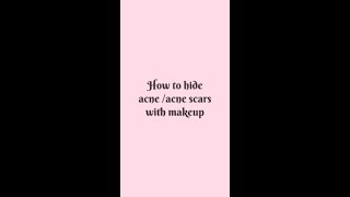 How to cover acne scars or open pores with makeup  Base Makeup for Acne prone skin [upl. by Hawken]