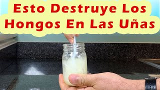 Esto Destruye Los Hongos En Las Uñas De Los Pies o De Las Manos  Remedio Para Hongos En Las Uñas [upl. by Lalo874]