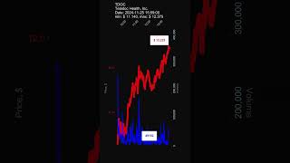 TDOC Teladoc Health Inc 20241125 stock prices dynamics stock of the day TDOC [upl. by Oicneconi]