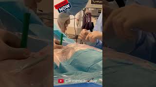 🧣TRAQUEOSTOMÍA PERCUTÁNEA en UCI🧣 enfermería hospital [upl. by Crocker518]