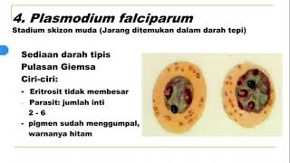 6a Identifikasi Malaria Plasmodium falciparum [upl. by Alvin]