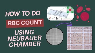 RBCs count by Neubauer Chamber [upl. by Gerhardt]