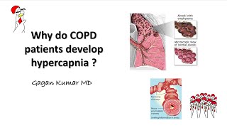 Why does COPD cause hypercapnia [upl. by Lrem564]