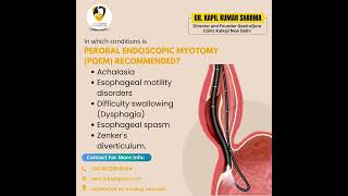 Peroral Endoscopic Myotomy POEM Recommended  Dr Kapil Sharma  MBBS MD DM Gastroenterology [upl. by Idona]