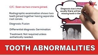 Tooth Abnormalities Some alterations in size [upl. by Fronniah936]