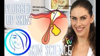 WHY DOES MY SKIN GET CLOGGED AND HOW TO GET RID OF CLOGGED PORES  Skin Science Episode 6 [upl. by Eerdua]