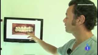 Reportaje  Precio y calidad de implantes dentales  Comando actualidad [upl. by Owades]