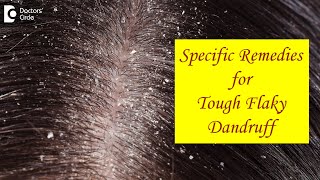 FLAKY SCALP DANDRUFF not cleared by Home Remedies What to do  Dr Amee Daxini  Doctors Circle [upl. by Yffub724]