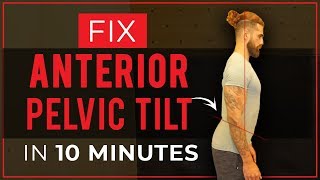 How To Fix ANTERIOR PELVIC TILT in 10 Mins Best Stretches and Exercises  Improve Your Posture [upl. by Jain55]