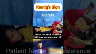 Kernigs sign meningitis shorts medical nursing NORCET [upl. by Adelina]