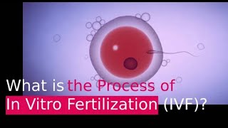 IVF PROCESS HELPFUL STEP BY STEP GUIDE In Vitro Fertilization [upl. by Yerffoej324]