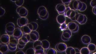 Rickettsia bacteria free in blood [upl. by Amathist349]