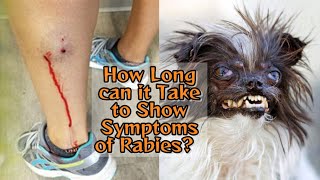 How Long can it Take to Show Symptoms of Rabies And What are the Common Symptoms and Prevention [upl. by Phyl]