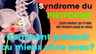 Prévenir ou mieux vivre avec le syndrome du piriforme en 3 points clés [upl. by Stacie]