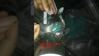 How to test malaria through malarial kit💉malarialtestprocedurebloodtest medicallife [upl. by Paton]