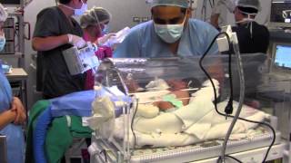 Primera intervención quirúrgica neonatal [upl. by Annahsat]