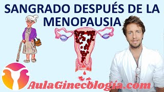 SANGRADO POSTMENOPÁUSICO Causas evaluación y riesgo de malignidad  Ginecología y Obstetricia [upl. by Tat]