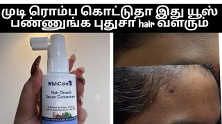 wishcare hair growth serum review tamil hairregrowth foreheadhairgrowth hairdensity [upl. by Lilybel]