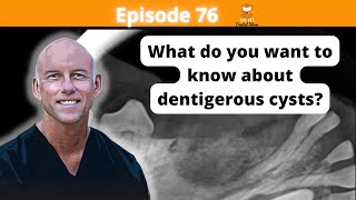 Ep 76  What do you want to know about dentigerous cysts [upl. by Otokam]