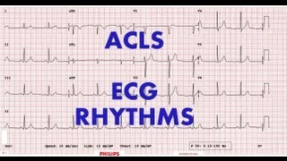 ACLS  ECG rhythm recognition amp management Part 1 [upl. by Nnawtna]