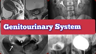 Radiology Viva Cases  200211  Genitourinary System Exam Cases medical radiology ultrasound [upl. by Assila]