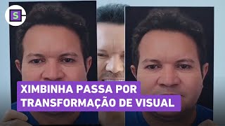 Ximbinha faz transformação no visual com direito a lipo e novo sorriso Mais mudanças [upl. by Chadabe608]