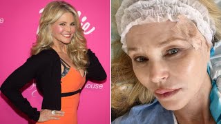 Christie Brinkley Announces Basal Cell Carcinoma Diagnosis and Urges Sun Protection [upl. by Arawaj]