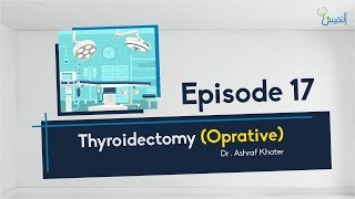 Thyroidectomy Oprative 01  Surgery  Prof Ashraf Khater [upl. by Bolling]