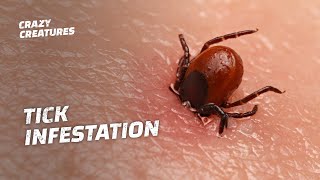 WARNING The Most Horrific Tick Infestations [upl. by Luna]